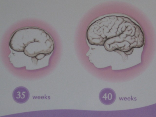 Baby's brain development